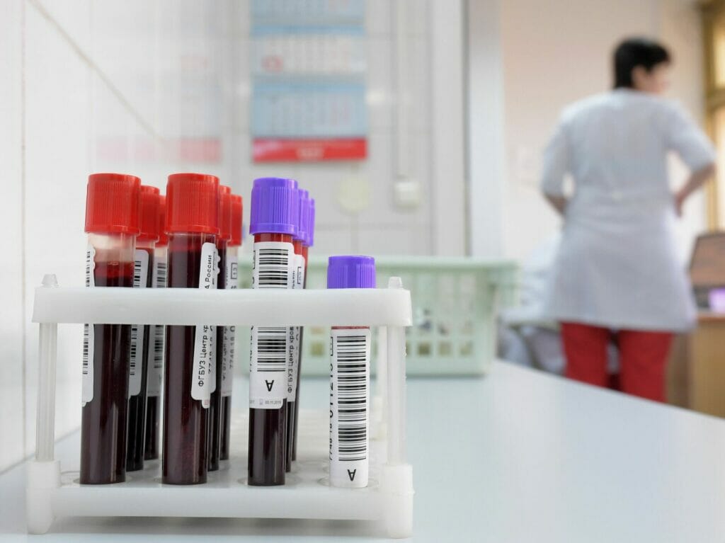 Японская компания обновит оборудование Республиканского центра крови