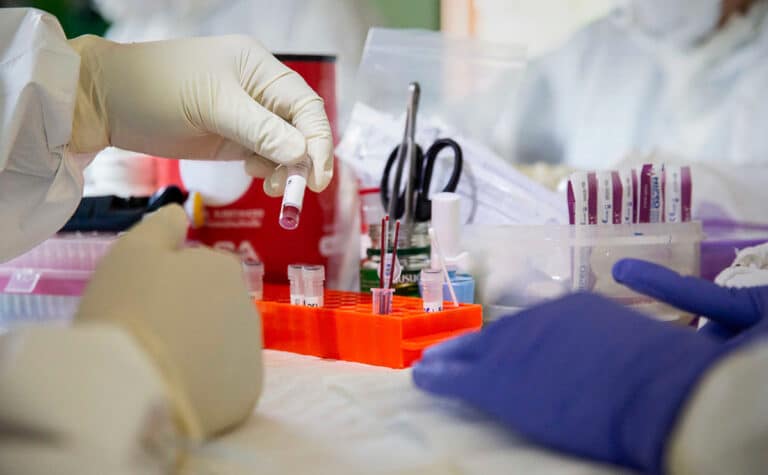 В 2025 году лечение получили 46,5 тыс. узбекистанцев с ВИЧ — ПРООН