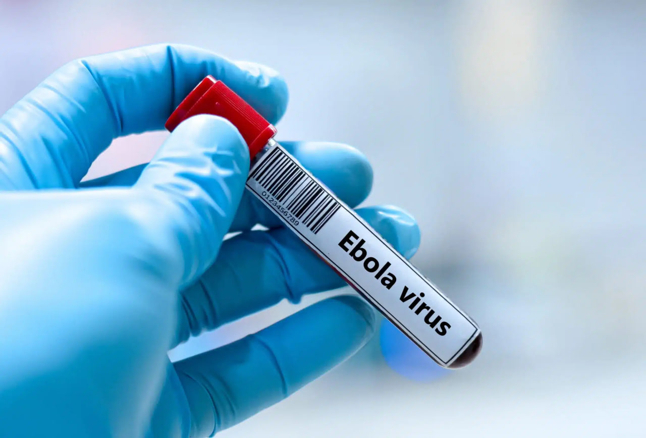 Kongoda Ebola virusi bo‘yicha yangi o‘choq aniqlandi