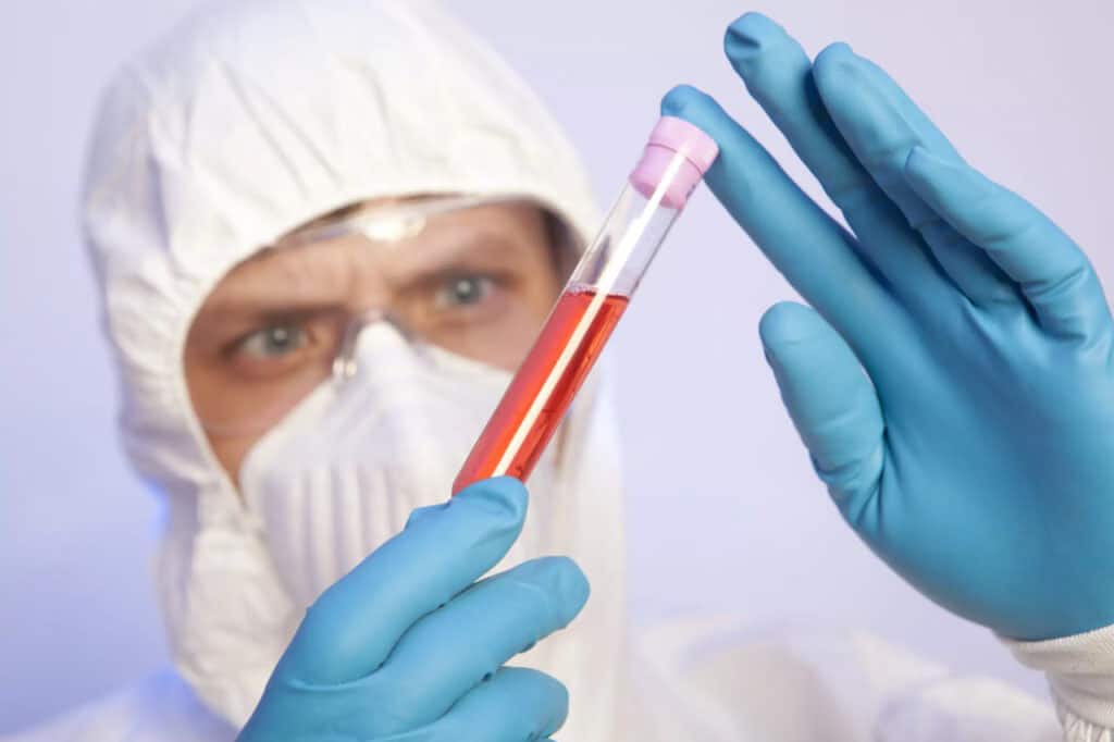 JSST Ebola epidemiyasining nazoratida ijobiy siljishlar borligini ma’lum qildi